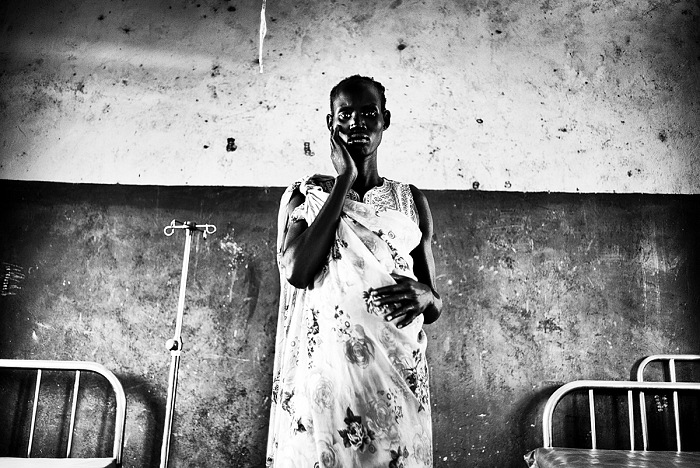Ugo Lucio Borga, una rifugiata incinta affetta da grave forma di malnutrizione causata dalla guerra civile, Mingkamann, Lakes, Sud Sudan.  Ugo Lucio Borga